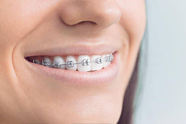 Best Wisdom Tooth Removal  in Pearl River, MS